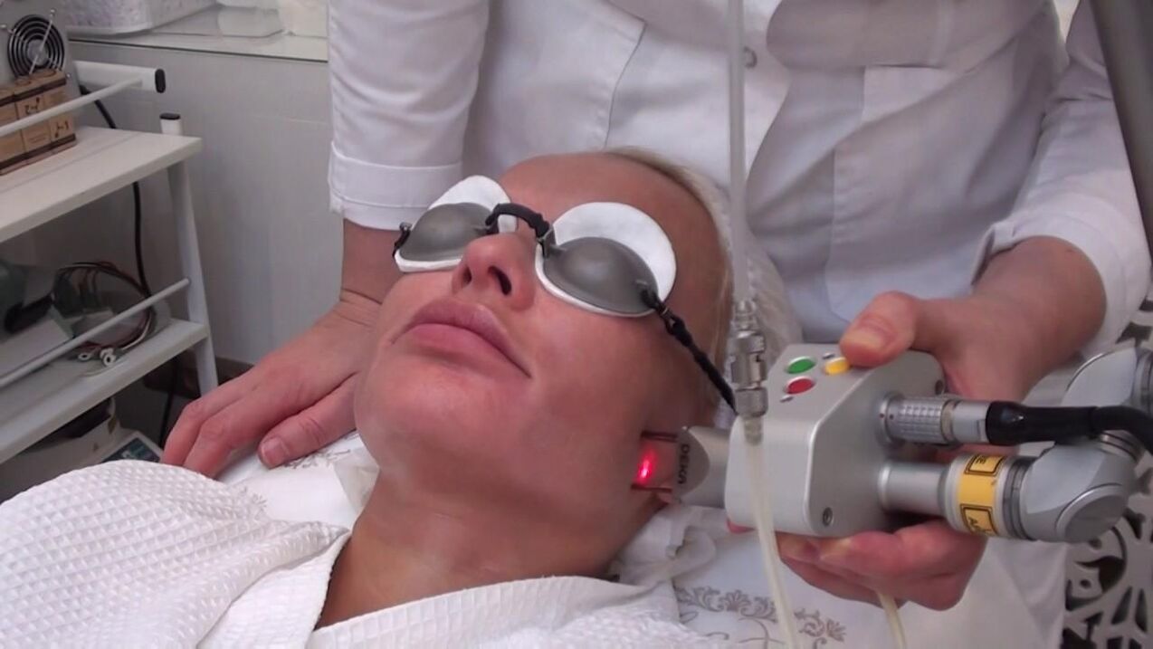 Laser beam treatment of problem areas of the facial skin