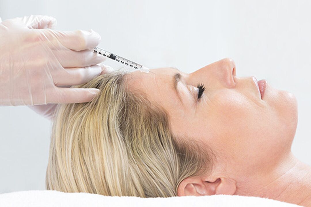 Plasmolifting is an injection method for facial skin rejuvenation